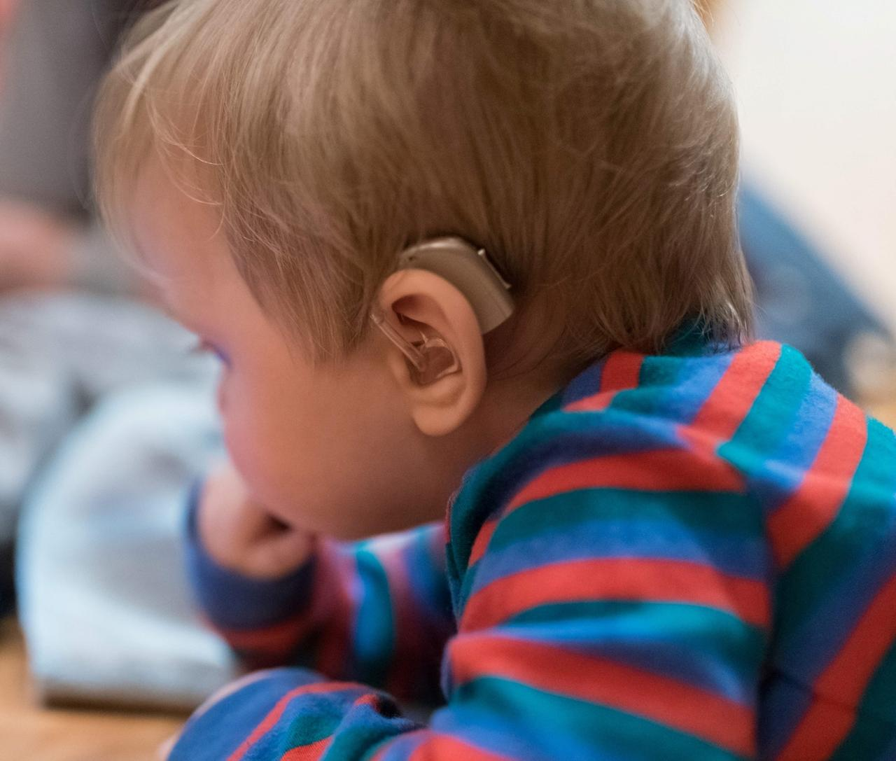 Young child wearing a beige behind-the-ear (BTE) hearing aid at MOM's Speech & Hearing Clinic, Vijayawada